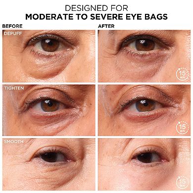 Bye Bye Under Eye Bags Daytime Treatment for Eye Bags, Puffiness and Crepey Skin