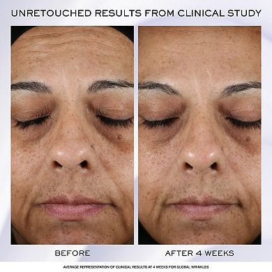 Renergie H.P.N. 300-Peptide Anti-Aging Cream