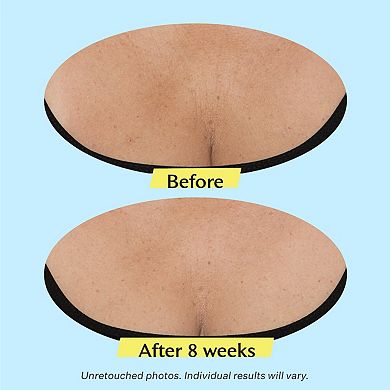 TL Advanced Tightening Neck Cream PLUS with Alpha-3 Peptide
