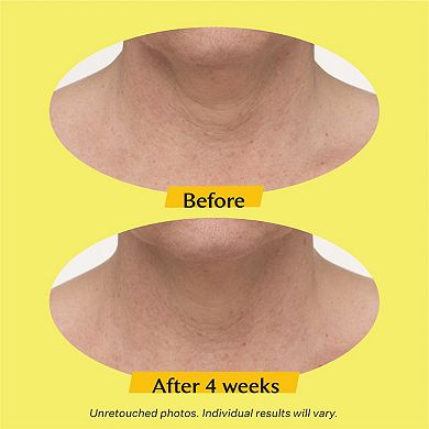 TL Advanced Tightening Neck Cream PLUS with Alpha-3 Peptide
