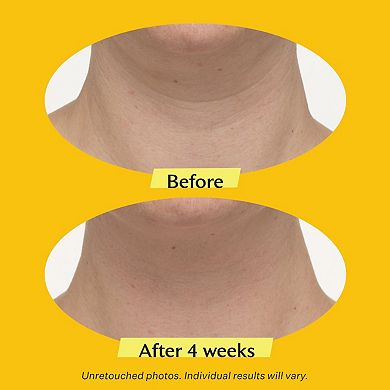 TL Advanced Tightening Neck Cream PLUS with Alpha-3 Peptide
