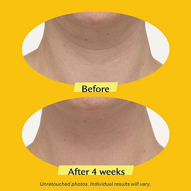 TL Advanced Tightening Neck Cream PLUS with Alpha-3 Peptide 