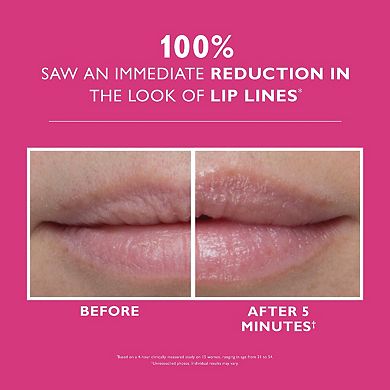 Instant FIRMx Lip Filler