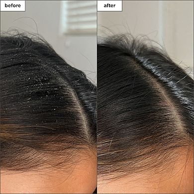 Scalp Revival Charcoal + Tea Tree Buildup Detox Spray