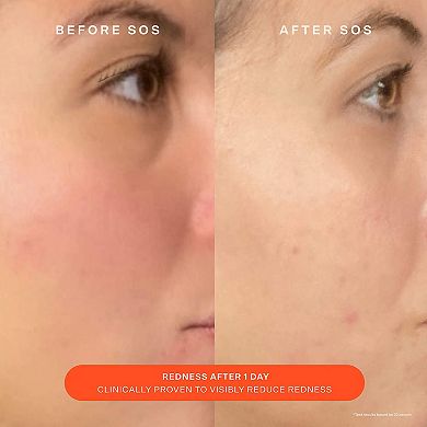 SOS Daily Skin Barrier Redness Recovery Moisturizer