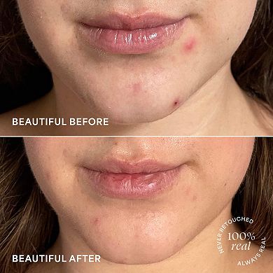 Brightening Treatment Drops Triple Vitamin C Serum