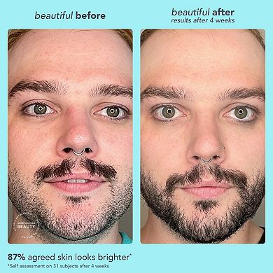 Bright Start Vitamin C Antioxidant Brightening Moisturizer