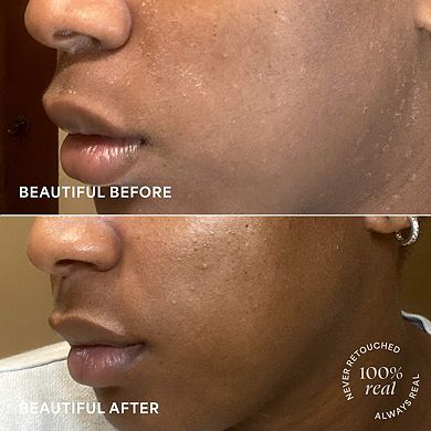 24-7 Moisture Intense Ultra Hydrating Day & Night Cream with Hyaluronic Acid + Squalane