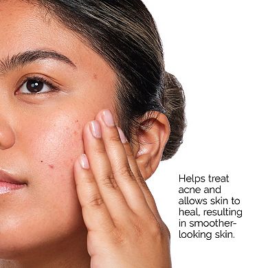 The Acne Set with Salicylic Acid