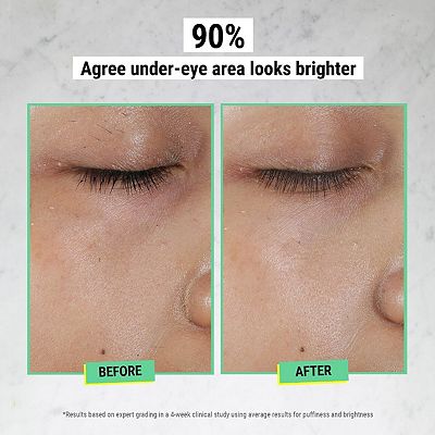 Kiehl's Since 1851 Creamy Eye Treatment with Avocado Duo