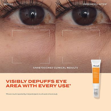 Targeted Eye Depuffer with Peptides