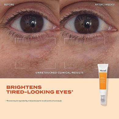 Targeted Eye Depuffer with Amino Acid Peptides
