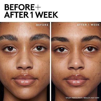 Cherry Dub Blah to Bright 5% AHA Face Mask with Salicylic Acid + Vitamin C