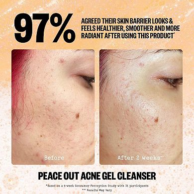 2% Salicylic Acid Acne Gel Cleanser