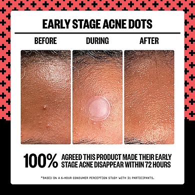 2% Salicylic Acid Early Stage Acne Dot