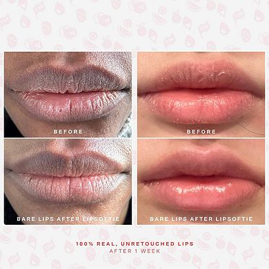 SOS LipSoftie Hydrating Lip Treatment Balm