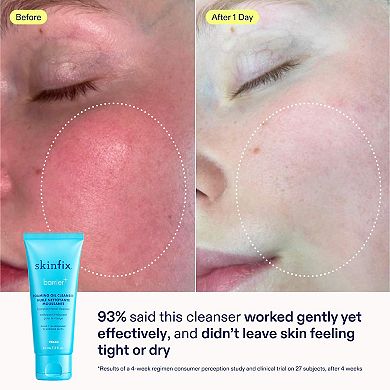 Better Skin Starts Here Kit for Dehydrated Skin
