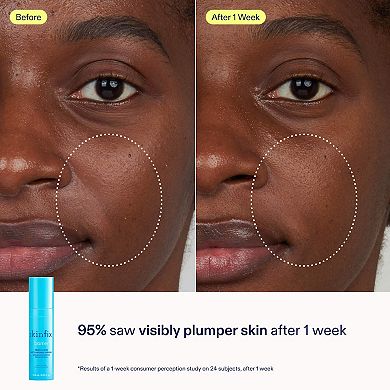 Better Skin Starts Here Kit for Dehydrated Skin