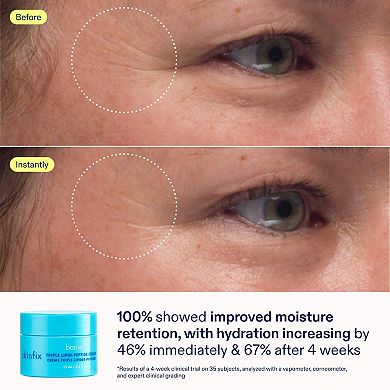 Better Skin Starts Here Kit for Dehydrated Skin