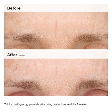 Retinal 0.2% Emulsion High-Strength Retinoid Nighttime Treatment