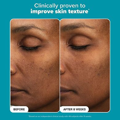 Mini Skin Perfecting 6% Mandelic Acid + 2% Lactic Acid Liquid Exfoliant