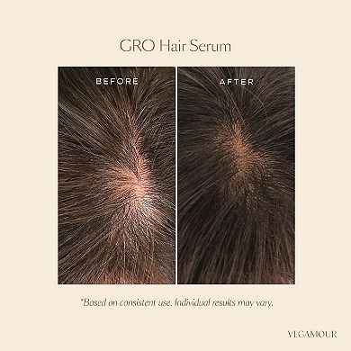 GRO Hair Serum & Biotin Gummies Set for Thinning Hair