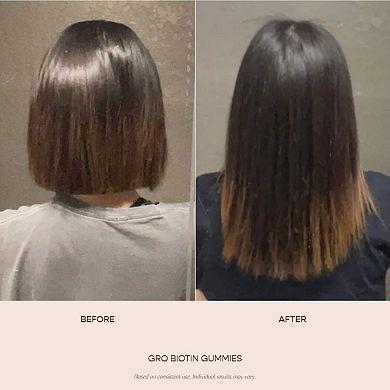 GRO Hair Serum & Biotin Gummies Set for Thinning Hair