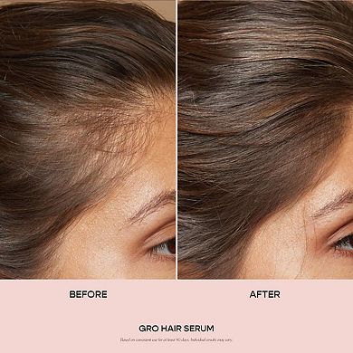 GRO Hair Serum Trio Set for Thinning Hair