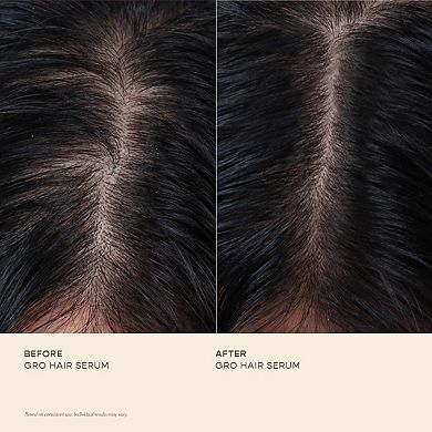GRO Hair Serum Trio Set for Thinning Hair