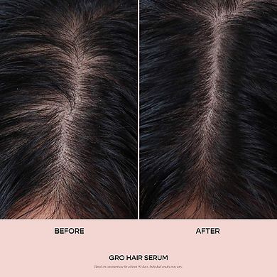 GRO Hair Serum Trio Set for Thinning Hair