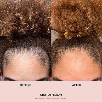 GRO Hair Serum Trio Set for Thinning Hair