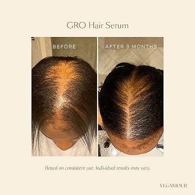 GRO Hair Serum for Thinning Hair