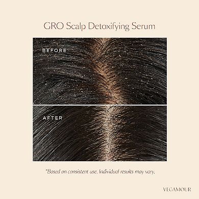 GRO Scalp Detox Clarifying Treatment for Dry, Flaky, Oily Scalp