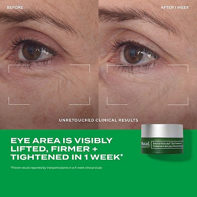 Retinal Resculpt Advanced Eye Lift Treatment for Aging Skin