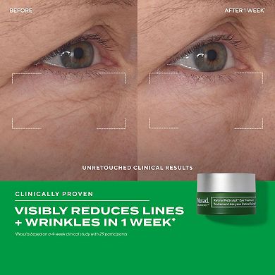 Retinal Resculpt Advanced Eye Lift Treatment for Aging Skin