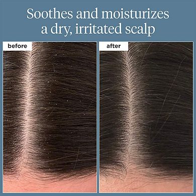 Mini Scalp Revival Rosemary Pre-Wash Scalp and Hair Oil