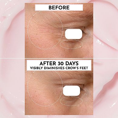 Forget the Filler Skin-Plumping Line-Smoothing Moisturizer + Makeup Primer