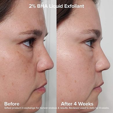 The Exfoliation Experience Kit with 2% BHA + 6% Mandelic Acid AHA