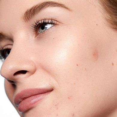Salicylic Acid Acne Day Dots