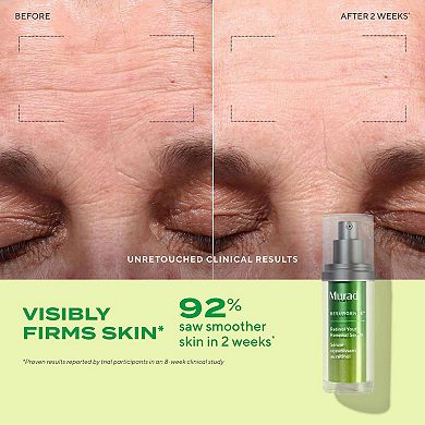 Retinol Youth Renewal Firming & Smoothing Serum with Hyaluronic Acid