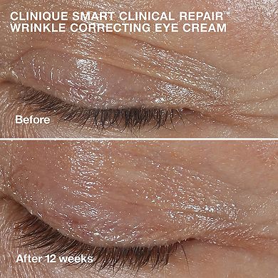 CLINIQUE De-Aging Skincare Experts
