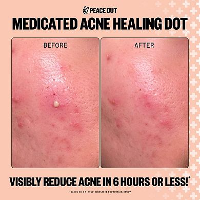 Acne Dot Mega Pack