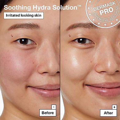 Soothing Hydra Solution PRO Face Mask for Irritated Skin