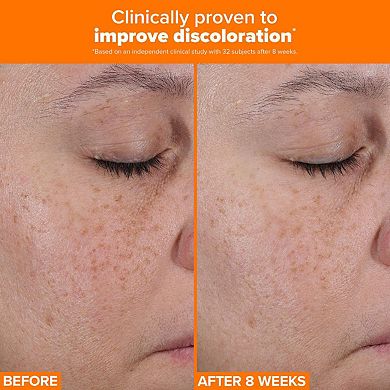 25% Vitamin C + Glutathione Clinical Serum for Brightening & Dark Spots