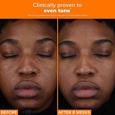 25% Vitamin C + Glutathione Clinical Serum for Brightening & Dark Spots