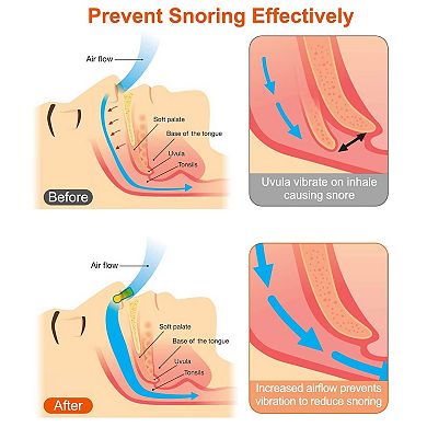 Magnetic Nose Clip Anti Snoring Device - White - Snore Stopper, Comfortable And Reusable