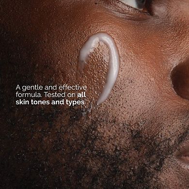 Niacinamide 5% Face and Body Emulsion for Dark Spots & Uneven Tone