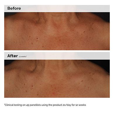 Niacinamide 5% Face and Body Emulsion for Dark Spots & Uneven Tone