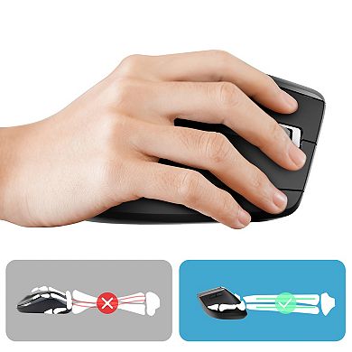 Delton G20 Wireless Ergonomic Keyboard & Optical Vertical Mouse Set (DKMKITERG20-WB)