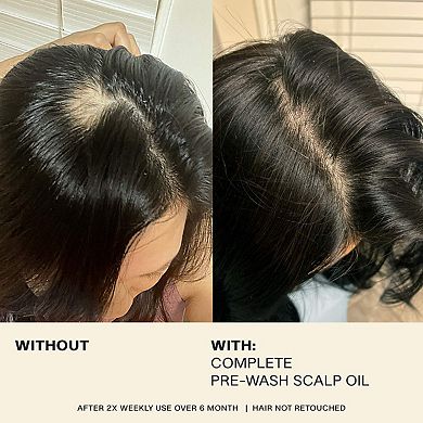 Complete Pre-Wash Scalp & Hair Strengthening Treatment Oil